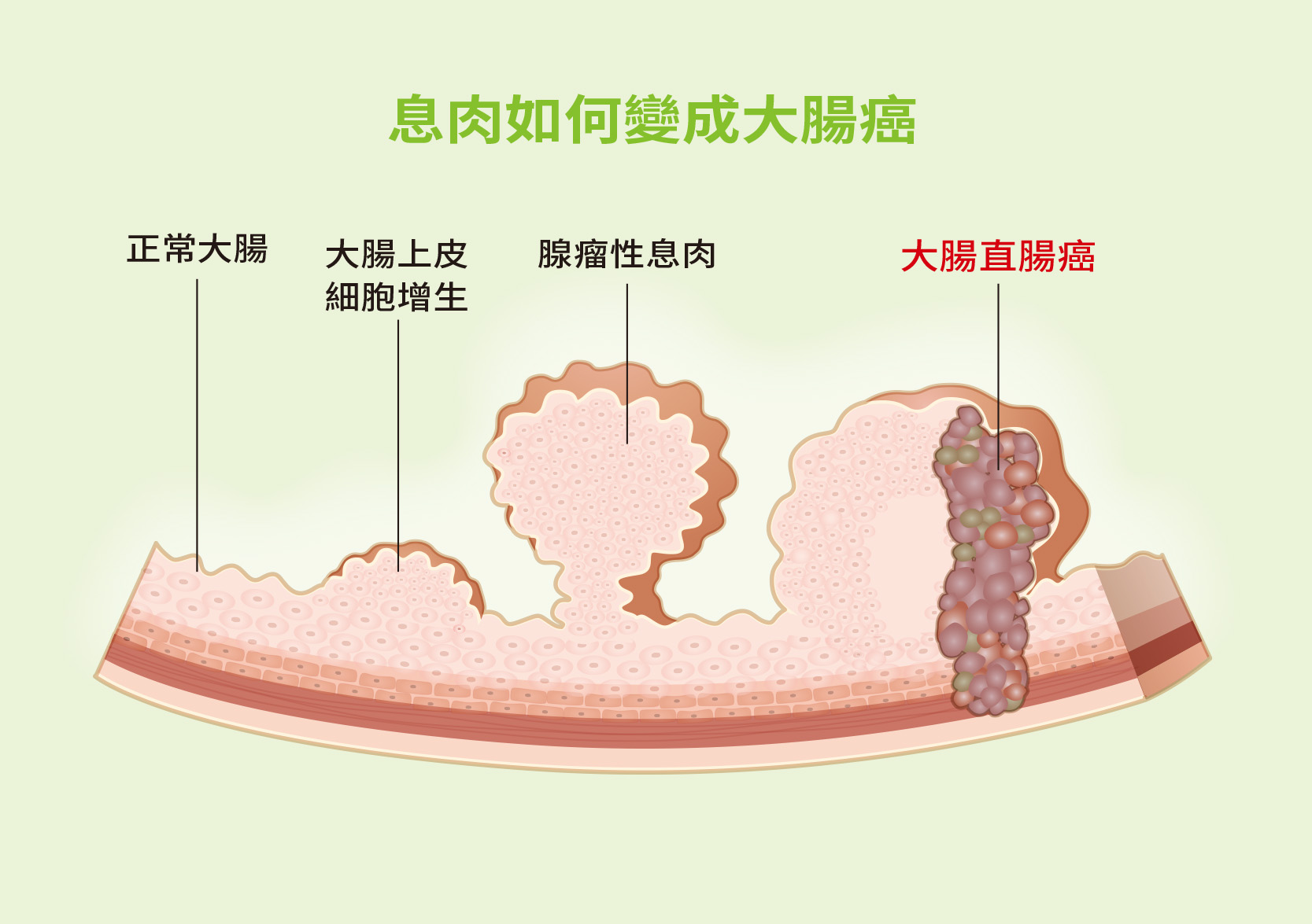 好心肝會刊 | 肝基會